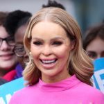 Katie Piper after acid attack treatment