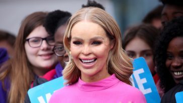 Katie Piper after acid attack treatment